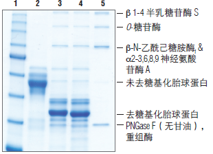 蛋白去糖基化混合液II--NEB