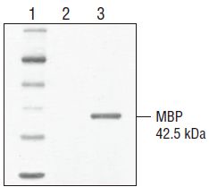 K. lactis GG799 感受态细胞--NEB